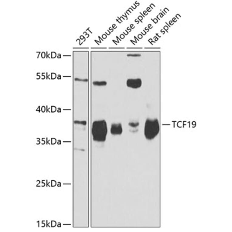 Western Blot - Anti-TCF19/SC1 Antibody (A15088) - Antibodies.com