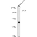 Western Blot - Anti-BORIS Antibody (A15089) - Antibodies.com