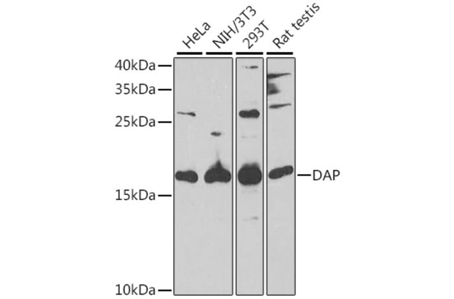 Western Blot - Anti-DAP1 Antibody (A15090) - Antibodies.com