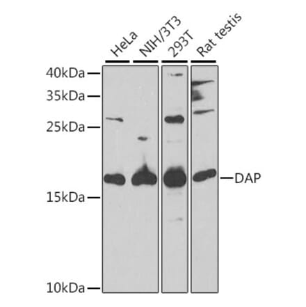 Western Blot - Anti-DAP1 Antibody (A15090) - Antibodies.com