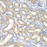 Immunohistochemistry - Anti-DAP1 Antibody (A15090) - Antibodies.com