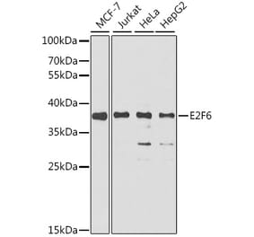 Western Blot - Anti-E2F6 Antibody (A6151) - Antibodies.com