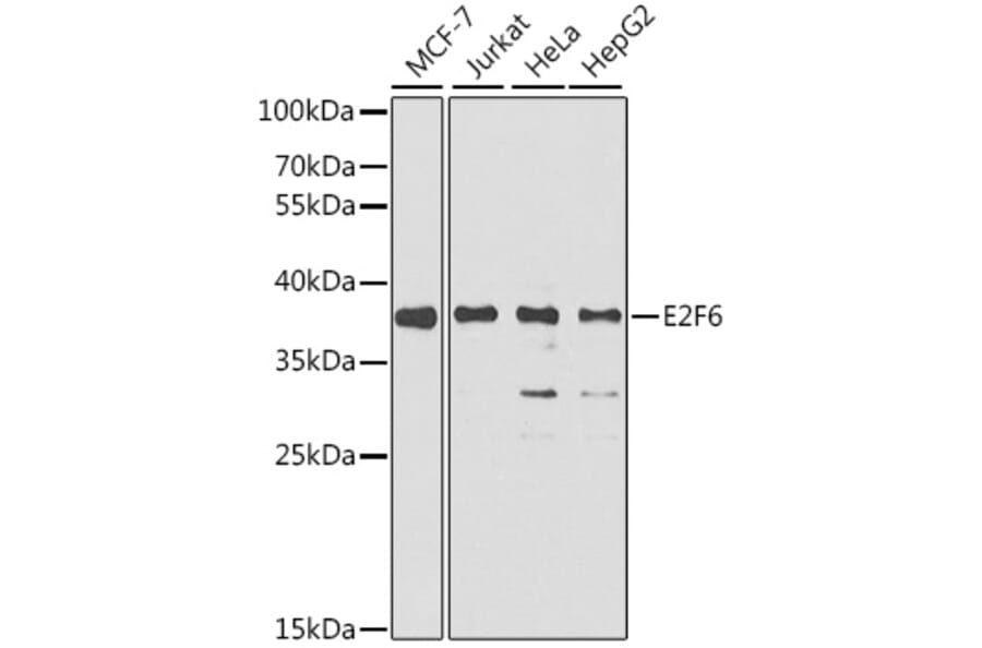 Western Blot - Anti-E2F6 Antibody (A6151) - Antibodies.com