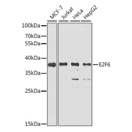 Western Blot - Anti-E2F6 Antibody (A6151) - Antibodies.com