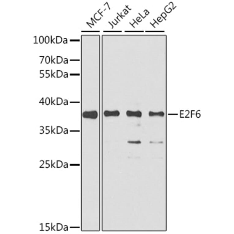 Western Blot - Anti-E2F6 Antibody (A6151) - Antibodies.com