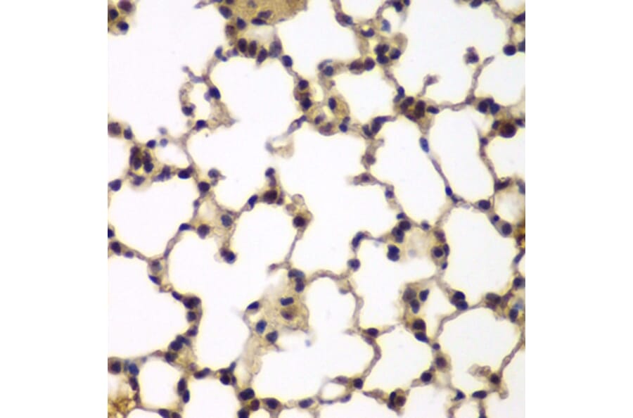Immunohistochemistry - Anti-E2F6 Antibody (A6151) - Antibodies.com