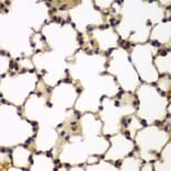 Immunohistochemistry - Anti-E2F6 Antibody (A6151) - Antibodies.com