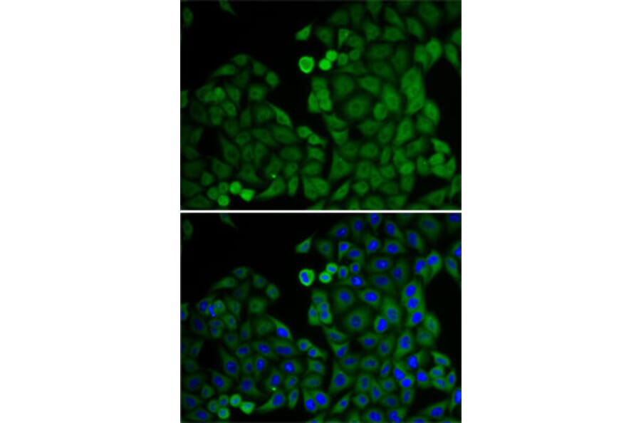 Immunofluorescence - Anti-E2F6 Antibody (A6151) - Antibodies.com