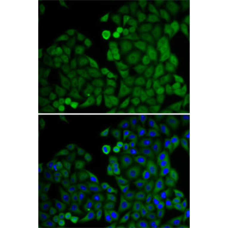 Immunofluorescence - Anti-E2F6 Antibody (A6151) - Antibodies.com