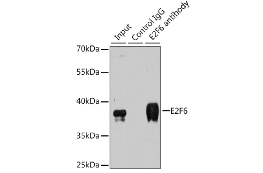 Immunoprecipitation - Anti-E2F6 Antibody (A6151) - Antibodies.com