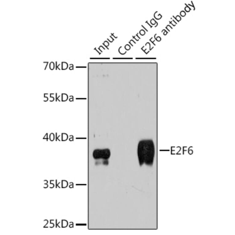 Immunoprecipitation - Anti-E2F6 Antibody (A6151) - Antibodies.com