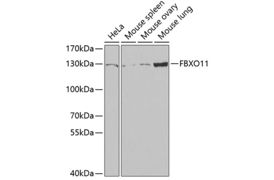 Western Blot - Anti-FBXO11 Antibody (A15092) - Antibodies.com