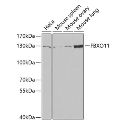 Western Blot - Anti-FBXO11 Antibody (A15092) - Antibodies.com