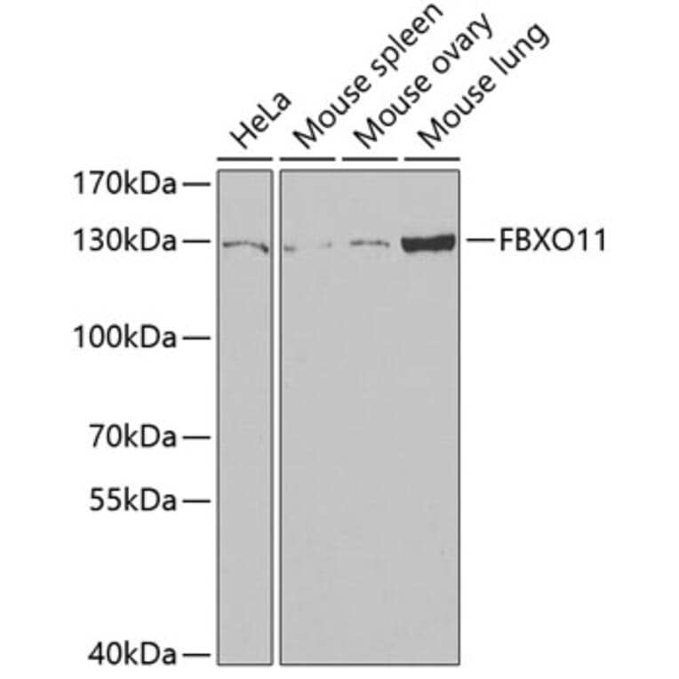 Western Blot - Anti-FBXO11 Antibody (A15092) - Antibodies.com