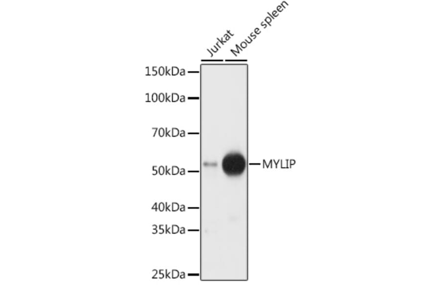 Western Blot - Anti-IDOL Antibody (A15094) - Antibodies.com