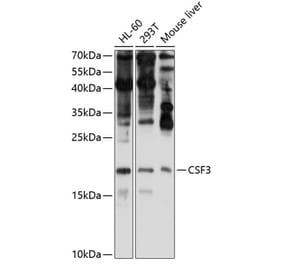 Western Blot - Anti-G-CSF Antibody (A15095) - Antibodies.com