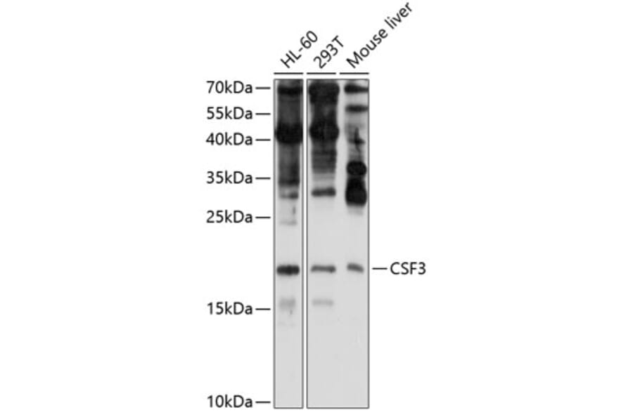 Western Blot - Anti-G-CSF Antibody (A15095) - Antibodies.com