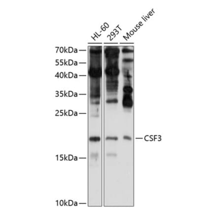 Western Blot - Anti-G-CSF Antibody (A15095) - Antibodies.com