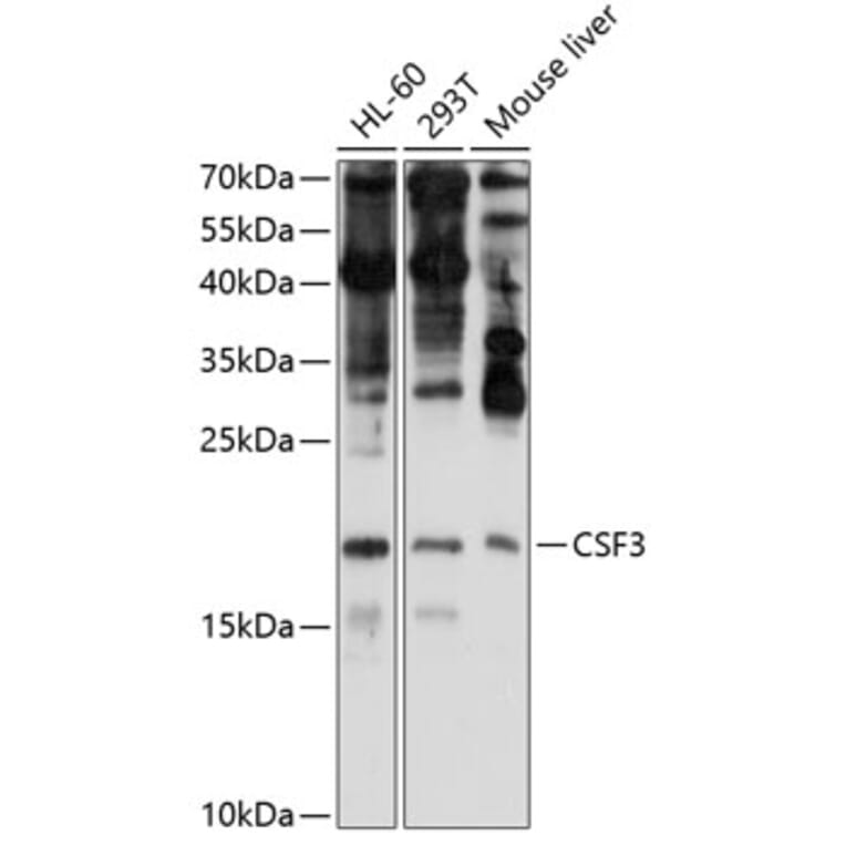 Western Blot - Anti-G-CSF Antibody (A15095) - Antibodies.com