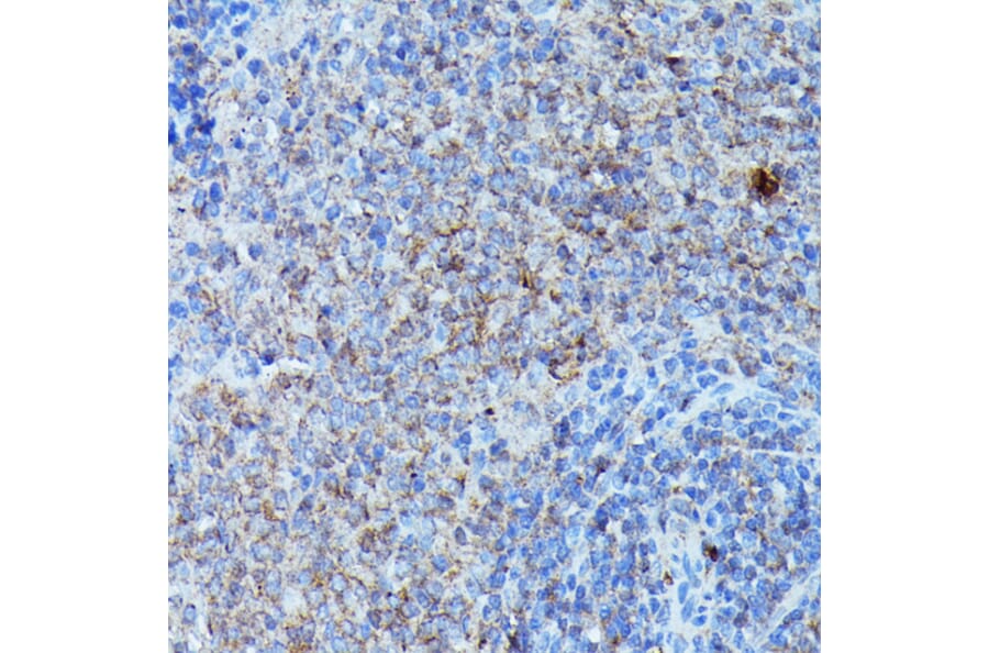 Immunohistochemistry - Anti-G-CSF Antibody (A15095) - Antibodies.com