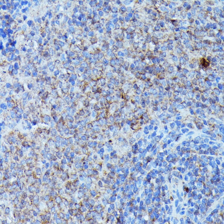 Immunohistochemistry - Anti-G-CSF Antibody (A15095) - Antibodies.com