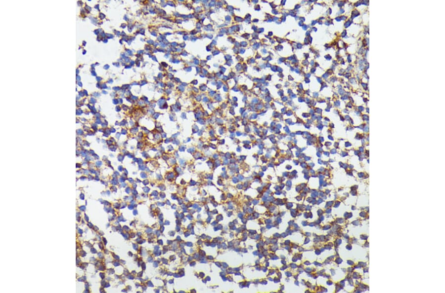 Immunohistochemistry - Anti-G-CSF Antibody (A15095) - Antibodies.com