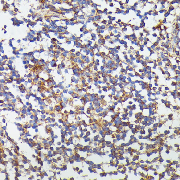 Immunohistochemistry - Anti-G-CSF Antibody (A15095) - Antibodies.com