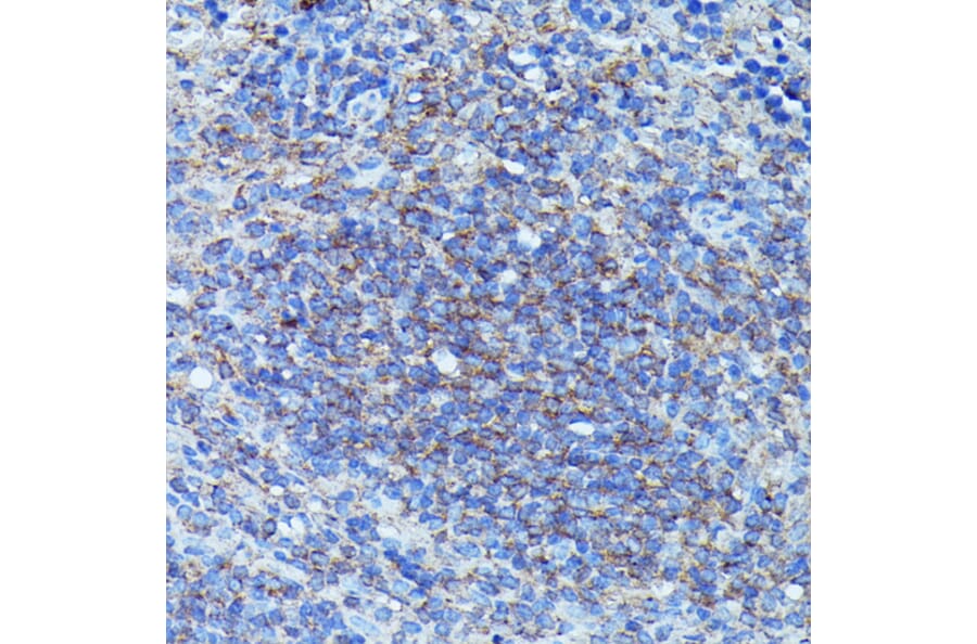 Immunohistochemistry - Anti-G-CSF Antibody (A15095) - Antibodies.com