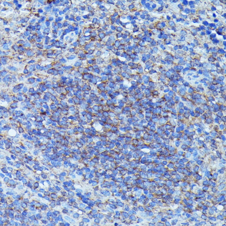 Immunohistochemistry - Anti-G-CSF Antibody (A15095) - Antibodies.com