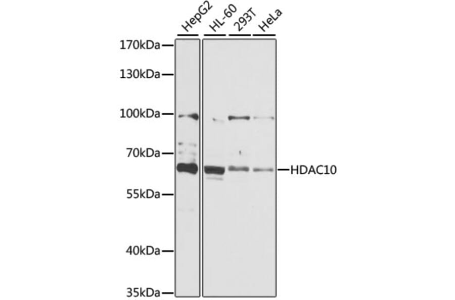 Western Blot - Anti-HDAC10 Antibody (A6184) - Antibodies.com