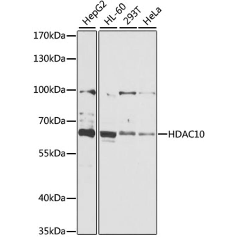Western Blot - Anti-HDAC10 Antibody (A6184) - Antibodies.com