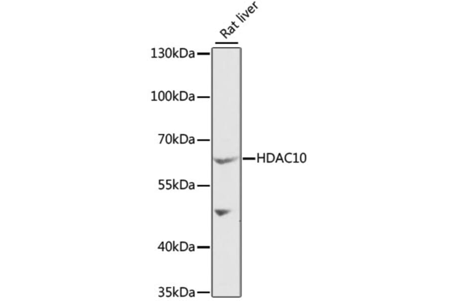 Western Blot - Anti-HDAC10 Antibody (A6184) - Antibodies.com