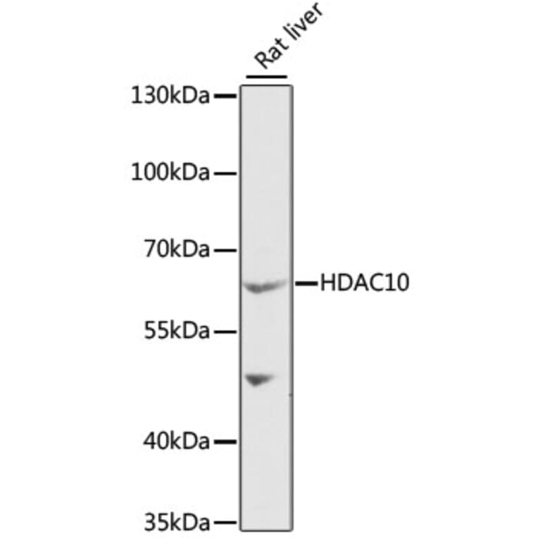 Western Blot - Anti-HDAC10 Antibody (A6184) - Antibodies.com