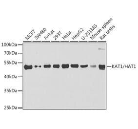 Western Blot - Anti-KAT1 / HAT1 Antibody (A15098) - Antibodies.com