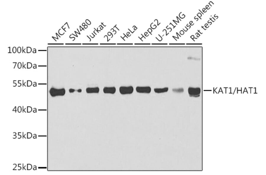 Western Blot - Anti-KAT1 / HAT1 Antibody (A15098) - Antibodies.com