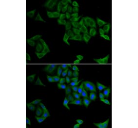 Immunofluorescence - Anti-SMYD5 Antibody (A15099) - Antibodies.com