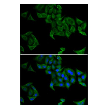 Immunofluorescence - Anti-SMYD5 Antibody (A15099) - Antibodies.com