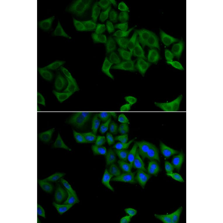 Immunofluorescence - Anti-SMYD5 Antibody (A15099) - Antibodies.com