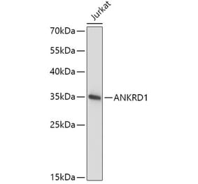 Western Blot - Anti-ANKRD1 Antibody (A15100) - Antibodies.com