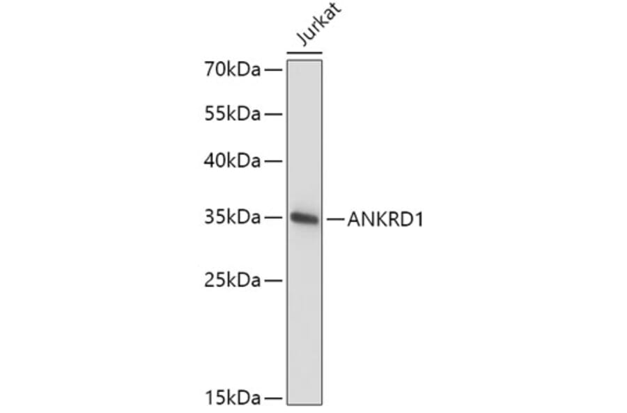 Western Blot - Anti-ANKRD1 Antibody (A15100) - Antibodies.com