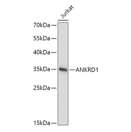 Western Blot - Anti-ANKRD1 Antibody (A15100) - Antibodies.com