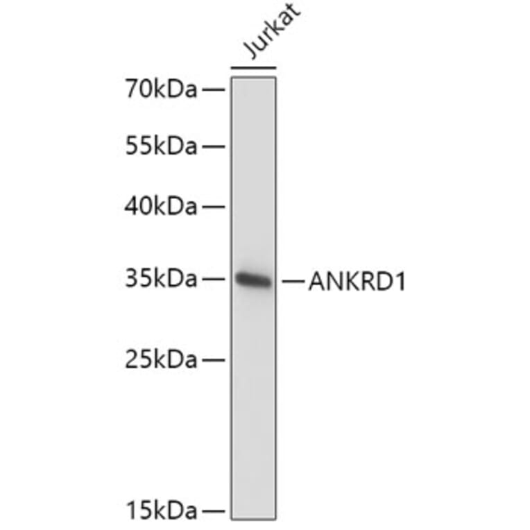 Western Blot - Anti-ANKRD1 Antibody (A15100) - Antibodies.com