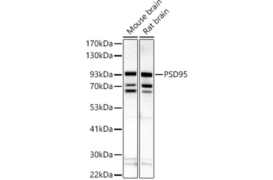 Western Blot - Anti-PSD95 Antibody (A15101) - Antibodies.com