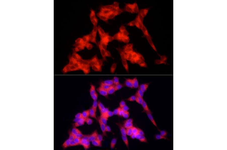 Immunofluorescence - Anti-PSD95 Antibody (A15101) - Antibodies.com