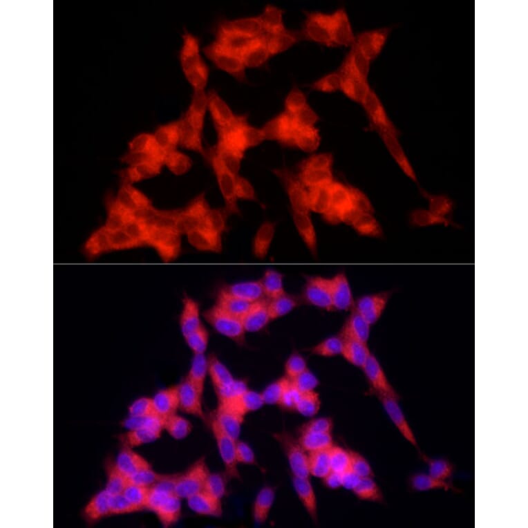 Immunofluorescence - Anti-PSD95 Antibody (A15101) - Antibodies.com