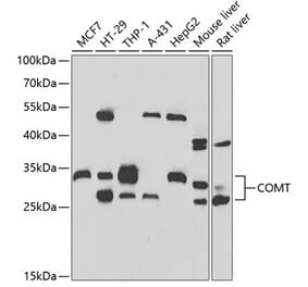 Western Blot - Anti-COMT Antibody (A15102) - Antibodies.com