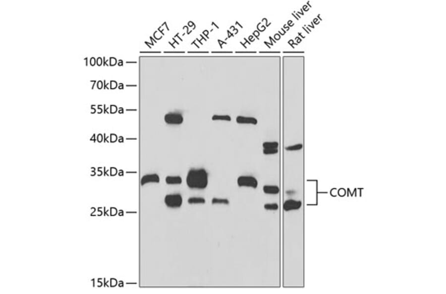 Western Blot - Anti-COMT Antibody (A15102) - Antibodies.com