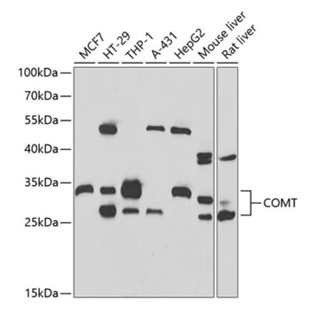 Western Blot - Anti-COMT Antibody (A15102) - Antibodies.com