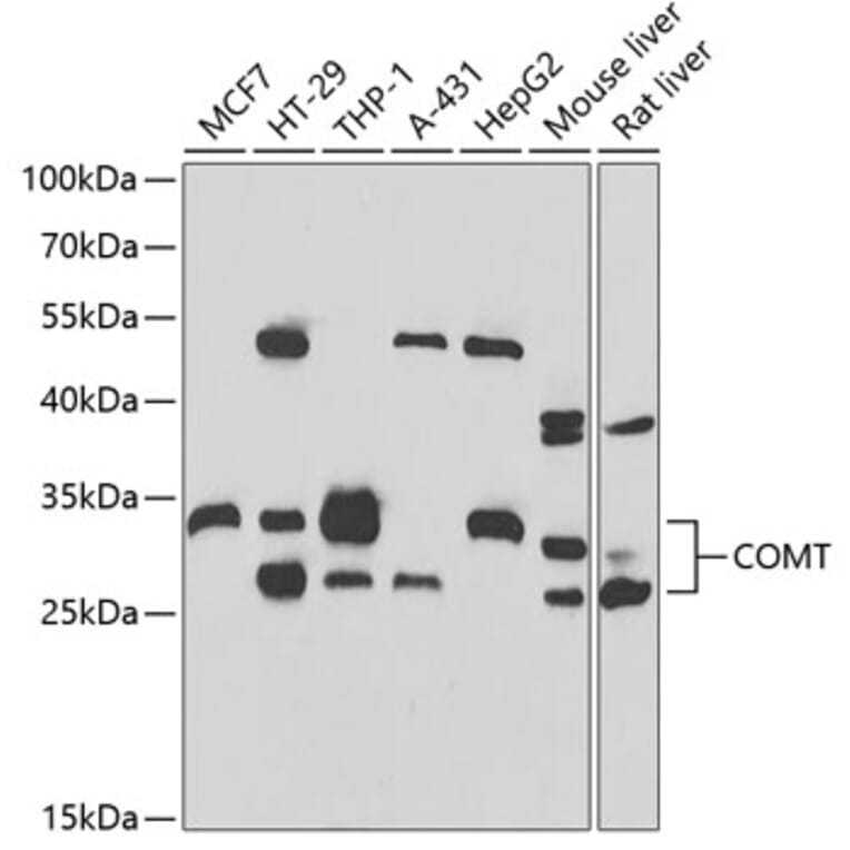 Western Blot - Anti-COMT Antibody (A15102) - Antibodies.com