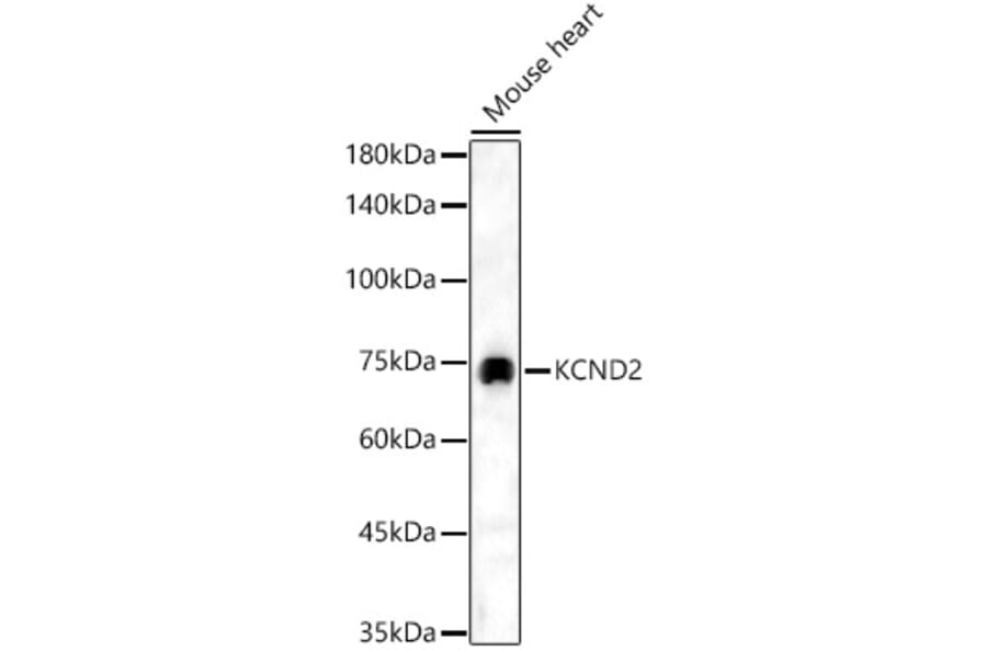 Western Blot - Anti-Kv4.2/KCND2 Antibody (A15103) - Antibodies.com